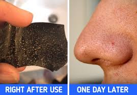 Instant Blackhead Removal Nose Strips – Clear, Smooth Skin 10/20/30 white or black